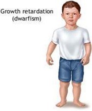growth retardation - Biochemden